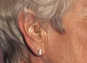 HearingAid.jpg